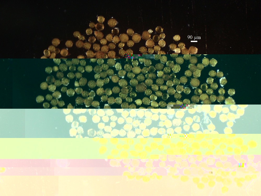 Entrophospora etunicata