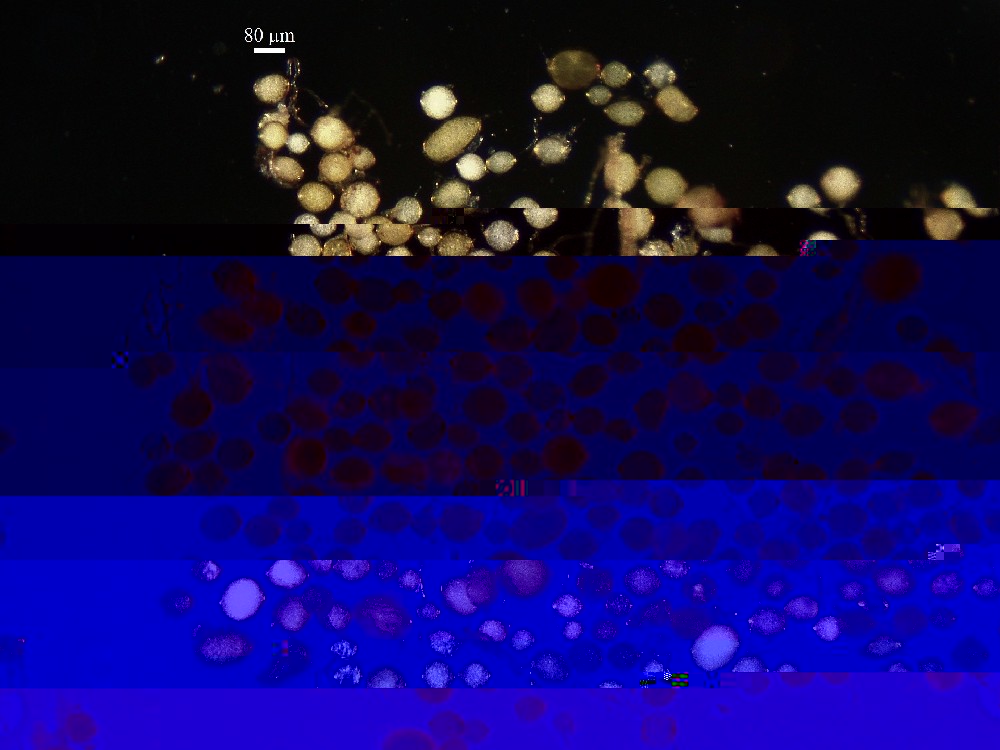 Rhizophagus irregularis